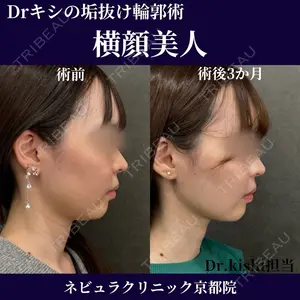 症例