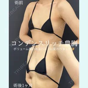 症例