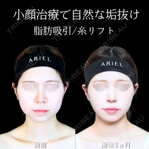 アリエル美容クリニック 大宮院 江郷隼一郎医師の症例