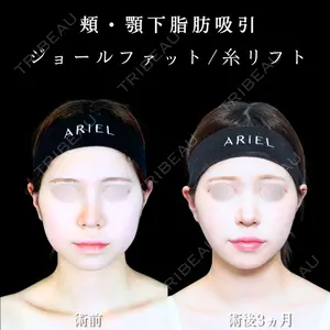 アリエル美容クリニック 大宮院 江郷隼一郎医師の症例