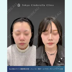 吉田 利之医師の症例