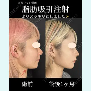 症例
