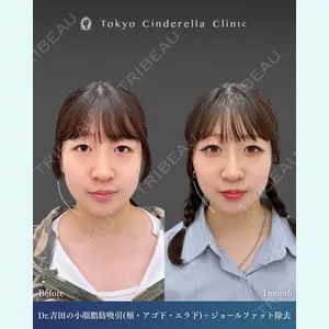 東京シンデレラ美容外科  横浜院 吉田 利之医師の症例