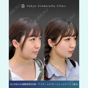 東京シンデレラ美容外科  横浜院 吉田 利之医師の症例