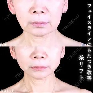 症例
