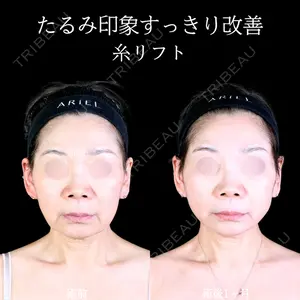 症例
