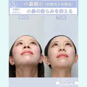 聖心美容クリニック 六本木院 佐藤 航司医師の症例