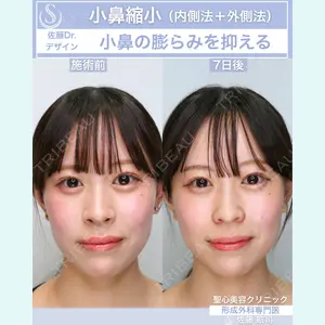 聖心美容クリニック 六本木院 佐藤 航司医師の症例