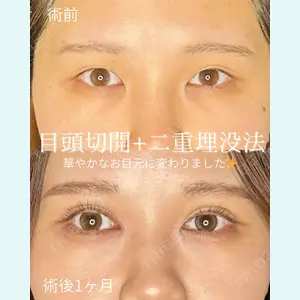 症例