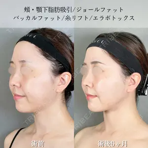 アリエル美容クリニック 大宮院 鈴木　桂介医師の症例
