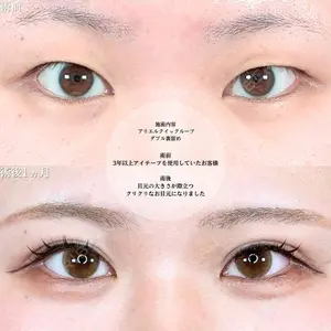 アリエル美容クリニック 横浜院 渡邉 光医師の症例
