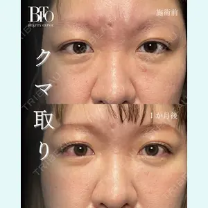 症例