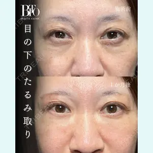 症例