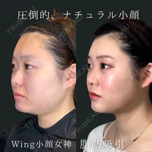 Wing clinic 豊中駅前院 速水 翼医師の症例