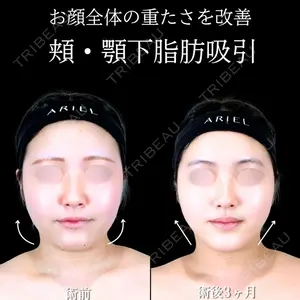 アリエル美容クリニック 横浜院 渡邉 光医師の症例