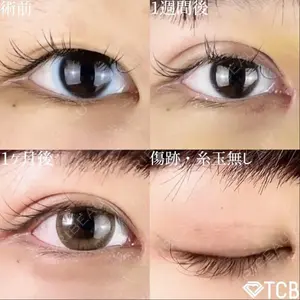 TCB東京中央美容外科 中野院の症例