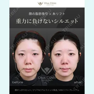 Otus Clinic 【オータスクリニック】 中 徳太郎医師の症例
