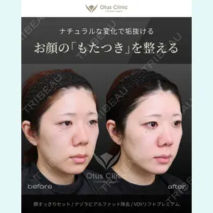 Otus Clinic 【オータスクリニック】 中 徳太郎医師の症例