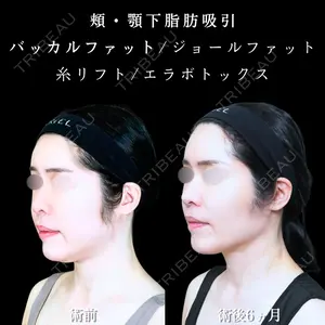 アリエル美容クリニック 大宮院 江郷隼一郎医師の症例