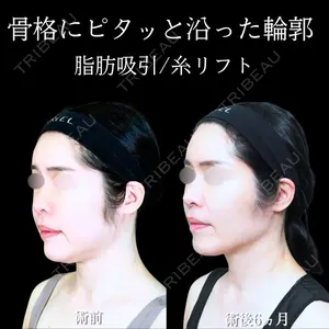 アリエル美容クリニック 大宮院 江郷隼一郎医師の症例