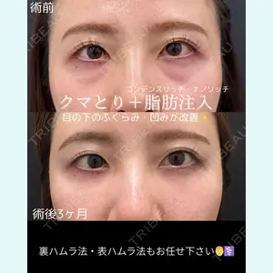 症例