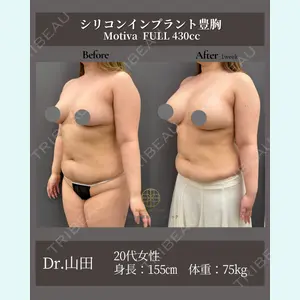症例