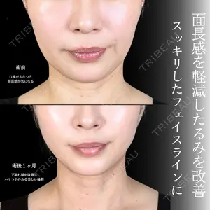 症例