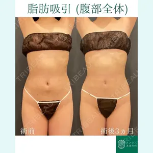 オアシス美容外科 遠藤 剛史医師の症例