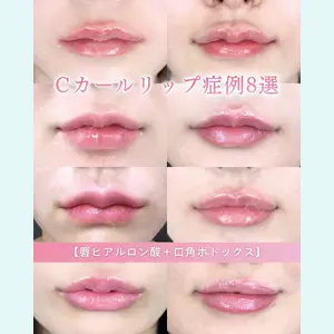 症例