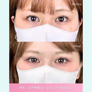 症例