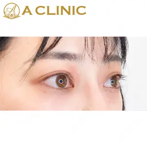 A CLINIC（エークリニック）横浜院の症例