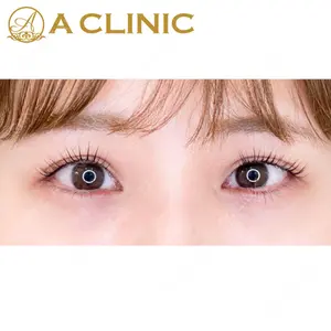 A CLINIC（エークリニック）横浜院の症例