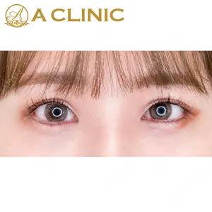 A CLINIC（エークリニック）横浜院の症例