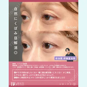 症例