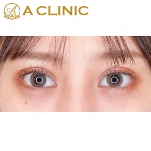 A CLINIC（エークリニック）横浜院の症例