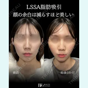 症例