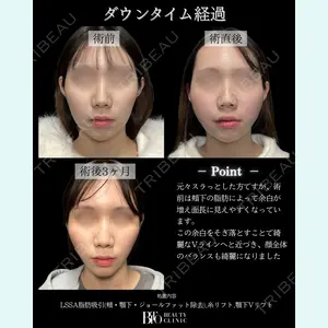 症例