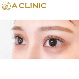 A CLINIC（エークリニック）横浜院の症例