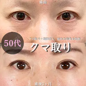 症例