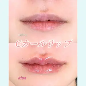 症例
