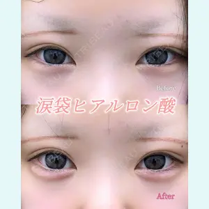 症例