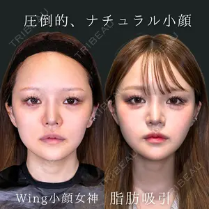 Wing clinic 豊中駅前院 速水 翼医師の症例