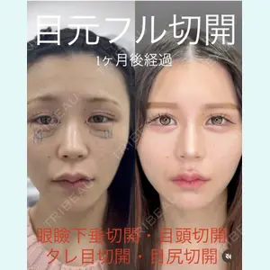 症例