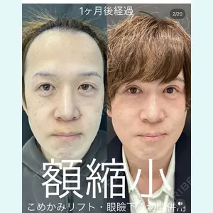 症例