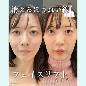 ルラ美容クリニック 渋谷本院 住友 沙織医師の症例