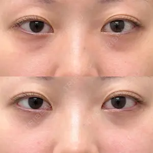 症例