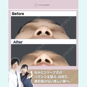 症例