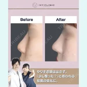 症例