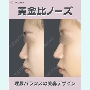 症例