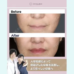 症例